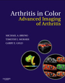 Arthritis in Color: Advanced Imaging of Arthritis