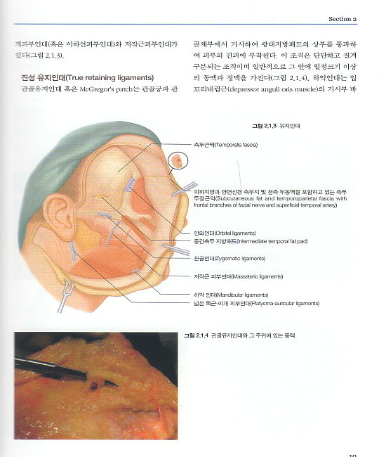 얼굴주름성형술