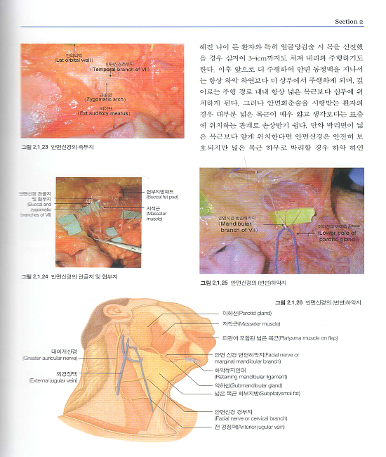 얼굴주름성형술