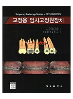 교정용 임시고정원장치 - Temporary Anchorage Devices in ORTHODONTICS