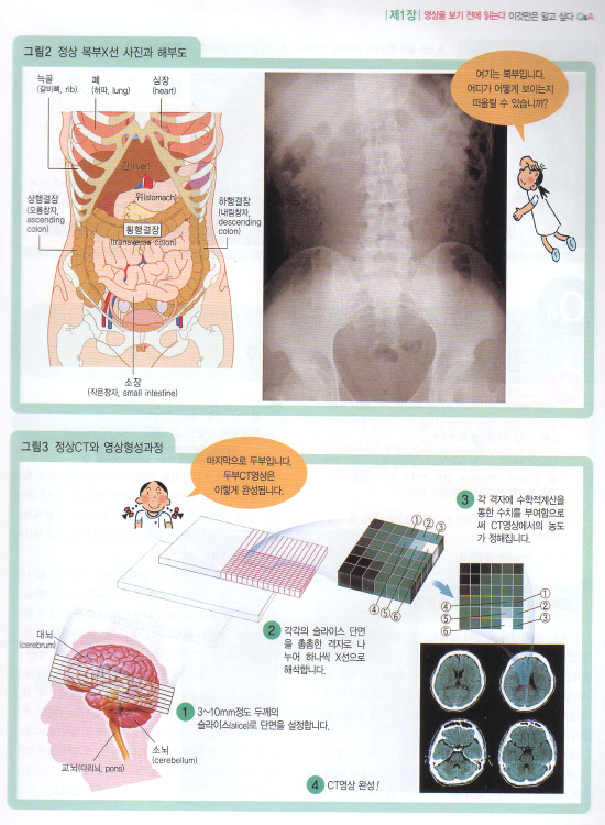 간호사를 위한 영상진단(최신)