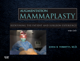 Augmentation Mammaplasty(With DVD)