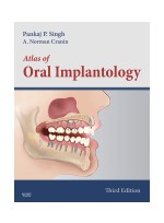 Atlas of Oral Implantology, 3/e