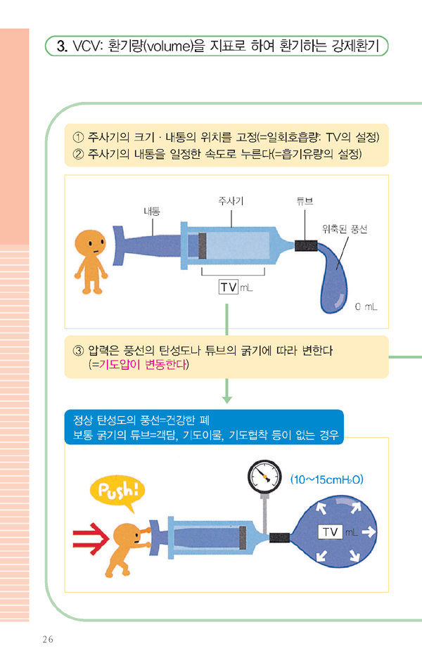 기계환기 매뉴얼 - 알기쉬운