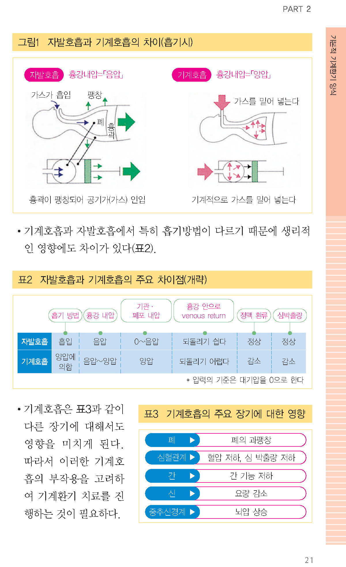 기계환기 매뉴얼 - 알기쉬운