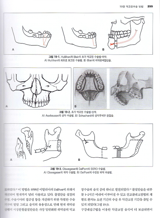 악안면 성형재건 외과학- 2판 (전2권)