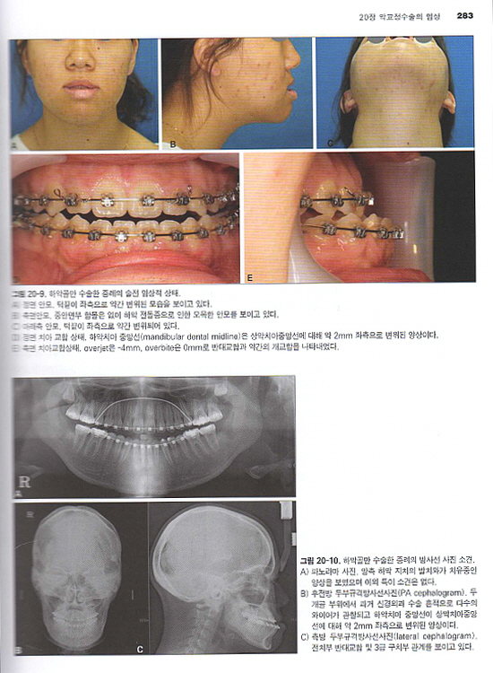 악안면 성형재건 외과학- 2판 (전2권)