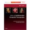 Atlas of Cardiovascular Computed Tomography: Imaging Companion to Braunwald's Heart Disease