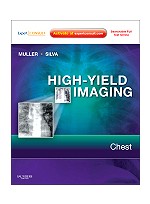 High-Yield Imaging: Chest - Expert Consult