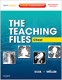 The Teaching Files: Chest - Expert Consult