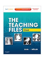 The Teaching Files: Chest - Expert Consult