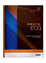 한눈에 알수있는 ECG