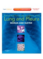 Tumors and Tumor-like Conditions of the Lung and Pleura