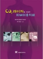 CO2 레이저를 이용한 피부미용치료