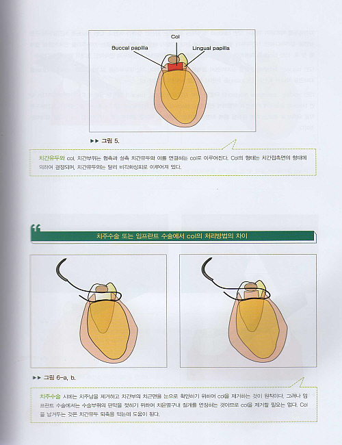 임프란트를 성공으로 이끄는 수술매뉴얼 Key of Implant (CD포함)