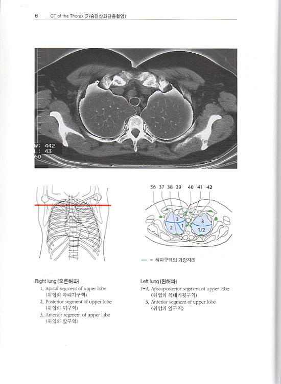 알기쉬운 원색 영상해부학 (CT & MRI)2 (Pocket Atlas of Sectional Anatomy) Vol. 2: Thorax (가슴), Heart (심장), Abdomen (배), Pelvis (골반)