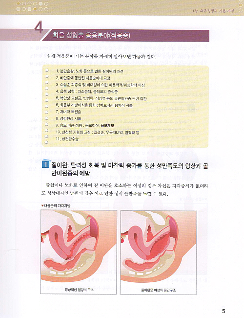 여성회음성형학,2판(개정판)