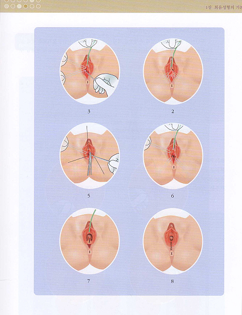 여성회음성형학,2판(개정판)