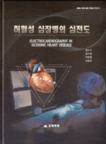 허혈성심장병의심전도(Electrocardiography in Ischemin Heart Disease)