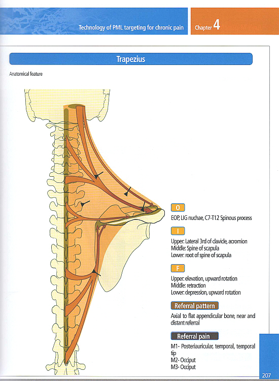 Jun\'s M-Puncture & pain model(영문판)