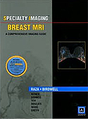 Specialty Imaging Breast MRI: A Comprehensive Imaging Guide