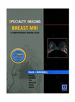 Specialty Imaging Breast MRI: A Comprehensive Imaging Guide