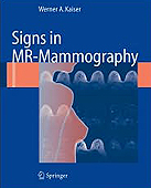 Signs in MR-Mammography