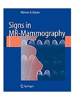 Signs in MR-Mammography