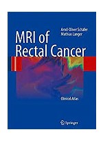 MRI of Rectal Cancer: Clinical Atlas
