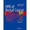 MRI of Rectal Cancer: Clinical Atlas