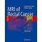 MRI of Rectal Cancer: Clinical Atlas