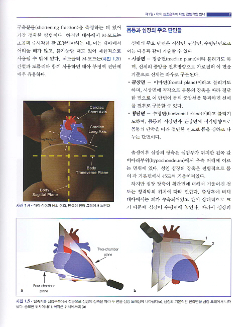 태아 심초음파 해부학 가이드라인 (DVD포함)