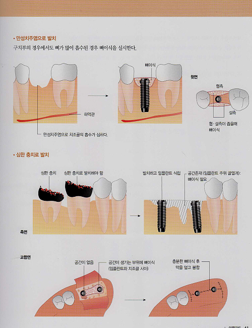 그림으로 보는 환자상담 Q & A (1권 ,2권 SET)