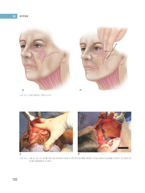 중안면성형 Midface Surgery, includes DVD