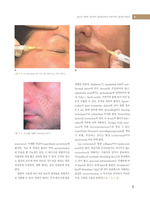 필러를 이용한 안면회춘술 Facial Rejuvenation with Fillers, Includes DVD