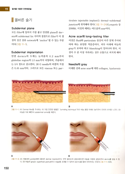 필러를 이용한 안면회춘술 Facial Rejuvenation with Fillers, Includes DVD