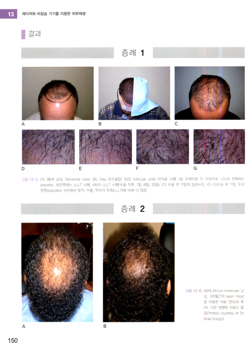 레이저와 비침습기기를 이용한 피부재생 Lasers and Non-Surgical Rejuvenation with DVD