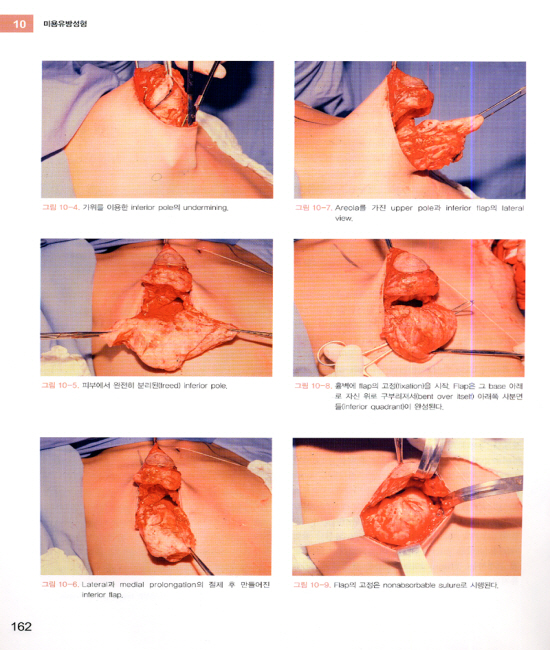 미용유방성형 Aesthetic Breast Surgery, includes DVD