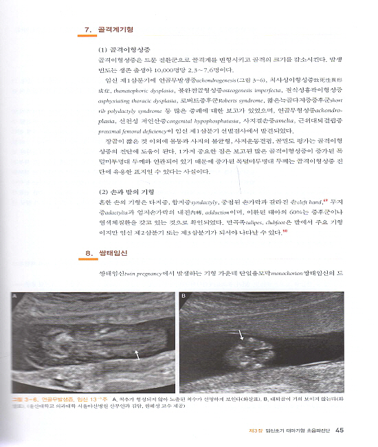 태아기형 초음파진단