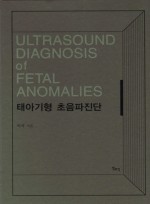 태아기형 초음파진단