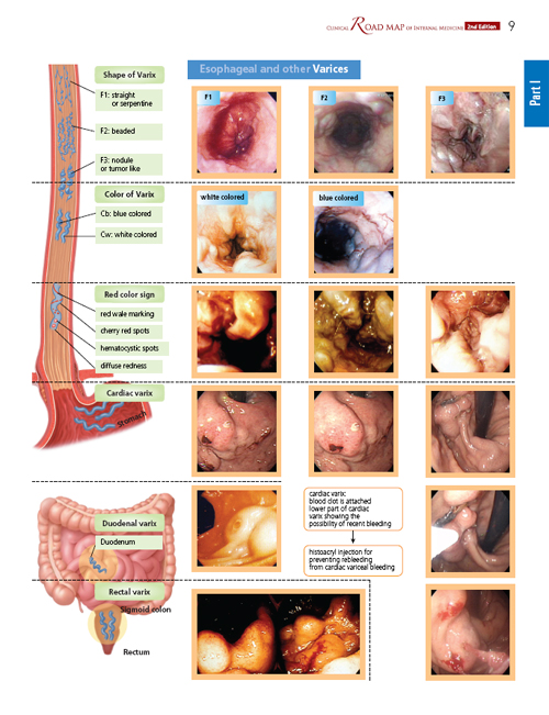 Clinical Road Map of Internal Medicine,2/e