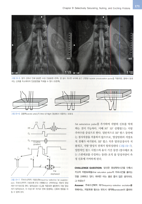 심혈관 자기공명영상 - 기초에서 임상까지 Cardiovascular MRI