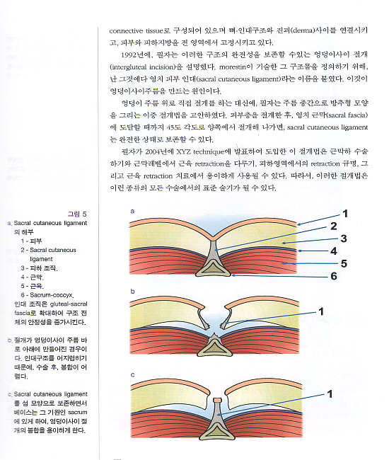 둔부성형술(허벅지와 종아리 윤곽술을 포함한)  DVD포함