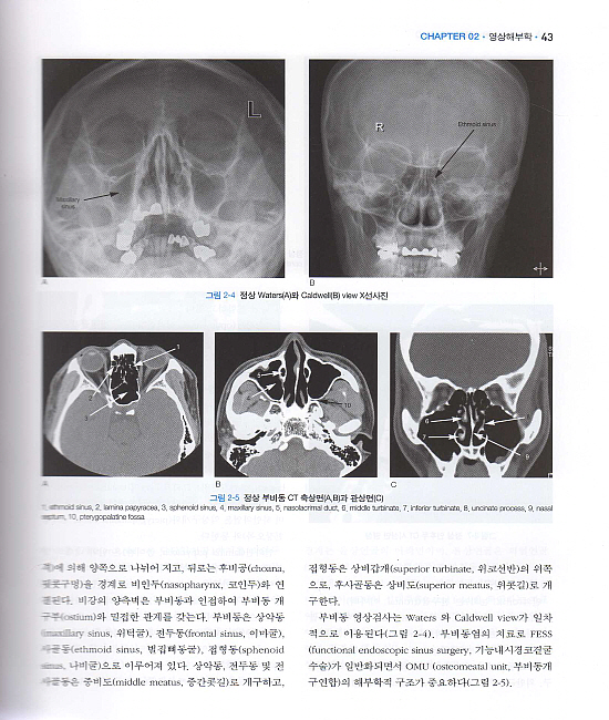 실전 영상의학