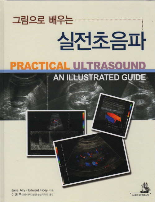 실전초음파 - 그림으로 배우는 Practical Ultrasound : An Illustrated Guide