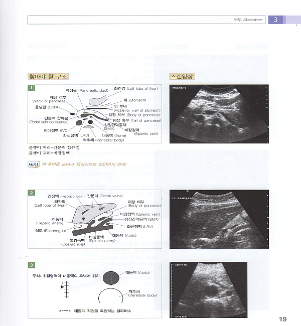 실전초음파 - 그림으로 배우는 Practical Ultrasound : An Illustrated Guide