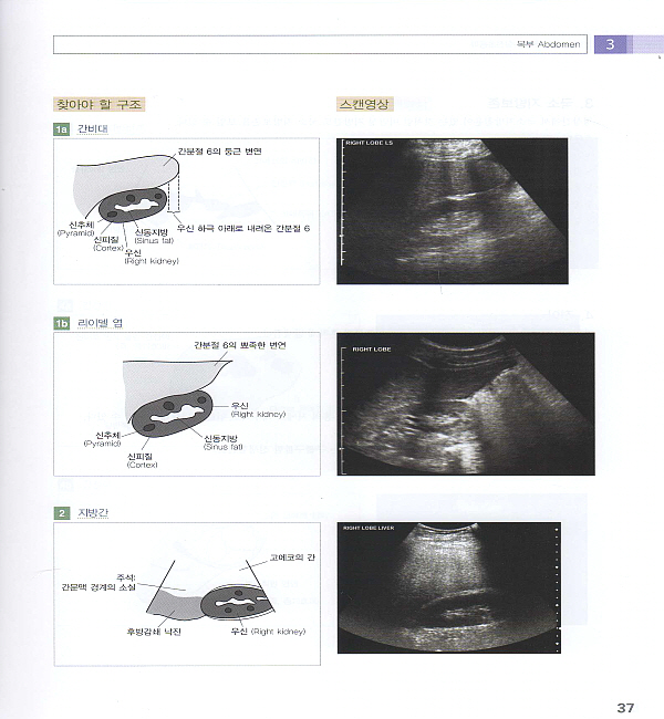 실전초음파 - 그림으로 배우는 Practical Ultrasound : An Illustrated Guide