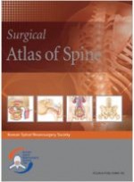 Surgical Atlas of Spine(척추수술아틀라스)