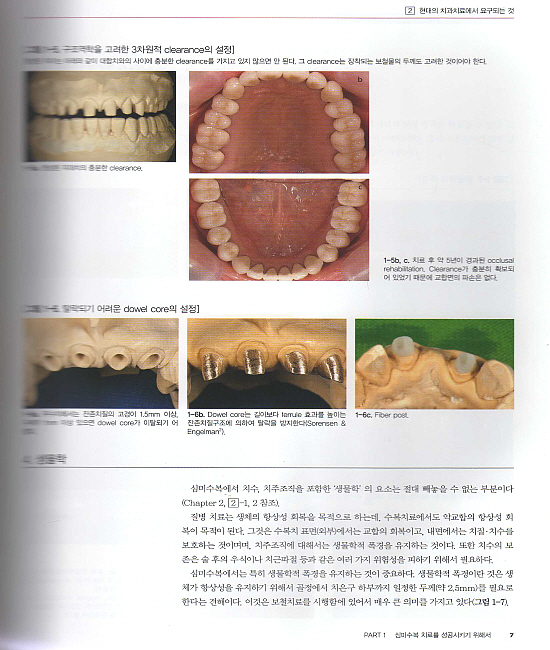 복잡한 심미수복의 분류와 치료