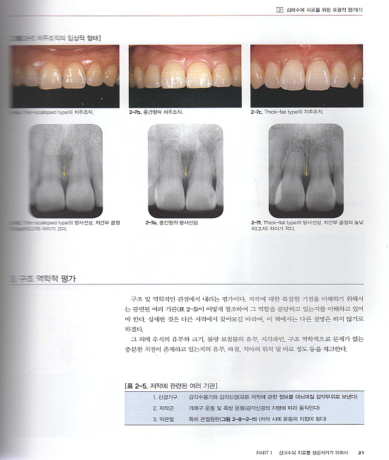 복잡한 심미수복의 분류와 치료